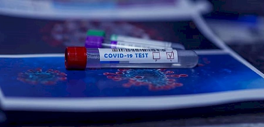 covid-19-coronavirus-quarantine-protection-disease-test 